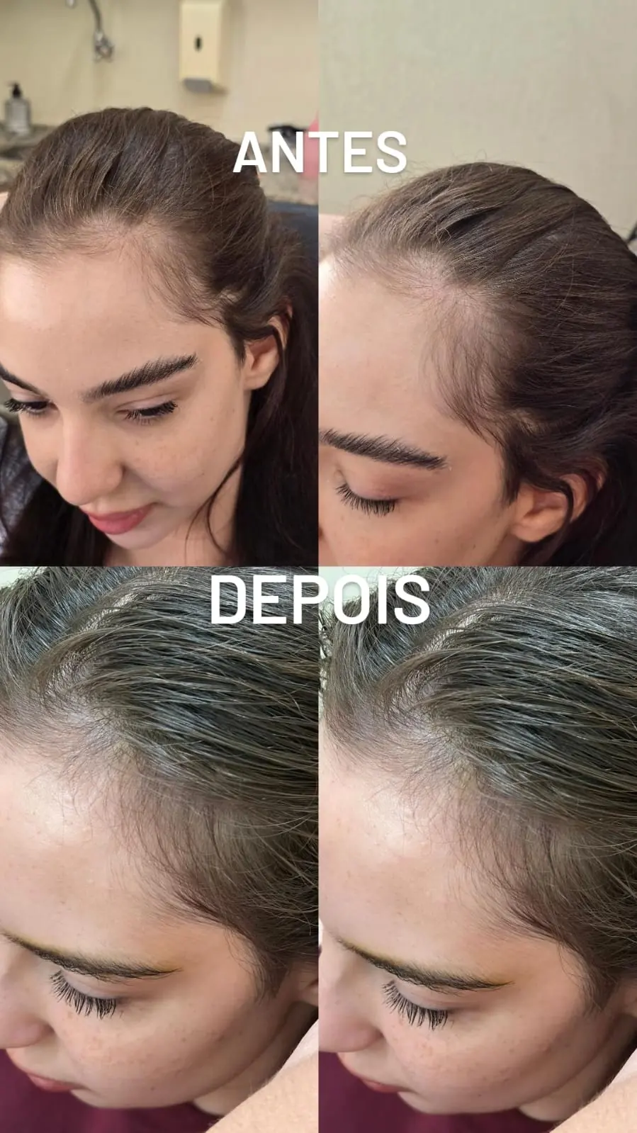 Antes e depois de tratamento capilar em Fernandópolis